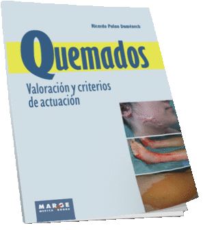 QUEMADOS. VALORACIN Y CRITERIOS DE ACTUACIN