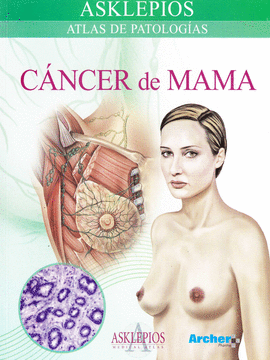ATLAS DE C�NCER DE MAMA