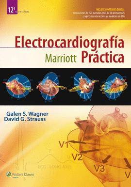 ELECTROCARDIOGRAFIA PRACTICA