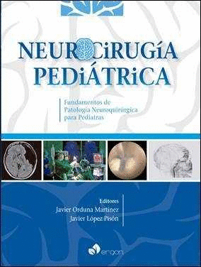 NEUROCIRUG�A PEDI�TRICA. FUNDAMENTOS DE PATOLOG�A NEUROQUIR�RGICA PATA PEDIATRAS