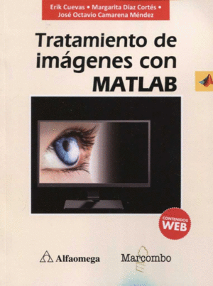 TRATAMIENTO DE IM�GENES CON MATLAB