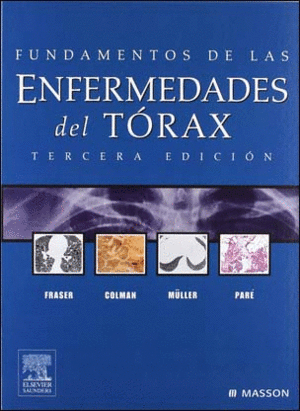 *** FUNDAMENTOS DE LAS ENFERMEDADES DEL TORAX 3 ED.