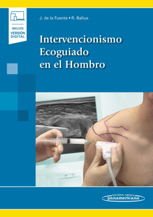INTERVENCIONISMO ECOGUIADO EN EL HOMBRO (INCLUYE EBOOK)
