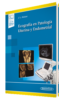 ECOGRAFA EN PATOLOGA UTERINA Y ENDOMETRIAL