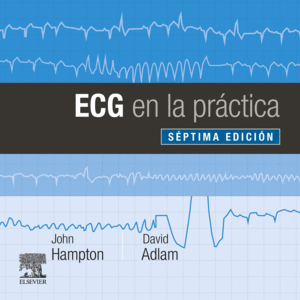 ECG EN LA PRACTICA