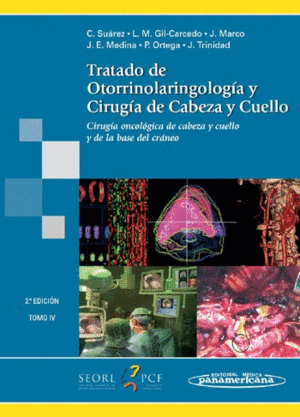 TRATADO OTORRINOLARINGOLOGIA CIRUGIA CABEZA Y CUELLO