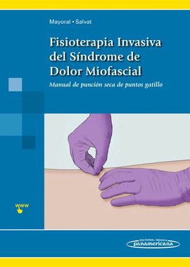 FISIOTERAPIA INVASIVA DEL S�NDROME DE DOLOR MIOFASCIAL
