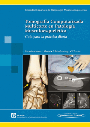 TOMOGRAFIA COMPUTERIZADA MULTICORTE EN PATOLOGA MUSCULOESQUELTICA