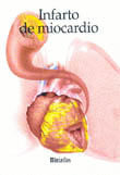 MINIATLAS INFARTO DE MIOCARDIO