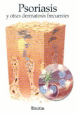 MINIATLAS PSORIASIS Y OTRAS DEMATOSIS FRECUENTES